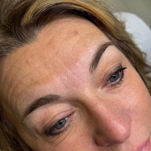 Pigmentation sourcils avant