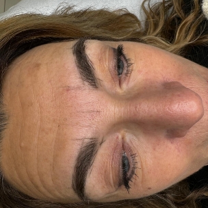 Pigmentation sourcils, mesure